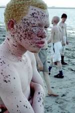 Watch Albino United 9Movies