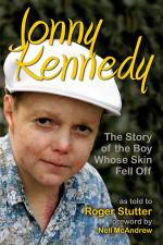 Watch The Boy Whose Skin Fell Off 9Movies