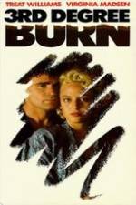 Watch Third Degree Burn 9Movies