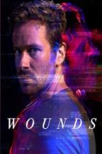 Watch Wounds 9Movies