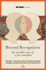 Watch Beyond Recognition: The Incredible Story of a Face Transplant 9Movies