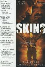 Watch Skins 9Movies
