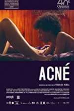 Watch Acné 9Movies