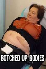 Watch Botched Up Bodies 9Movies