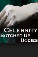 Watch Celebrity Botched Up Bodies 9Movies